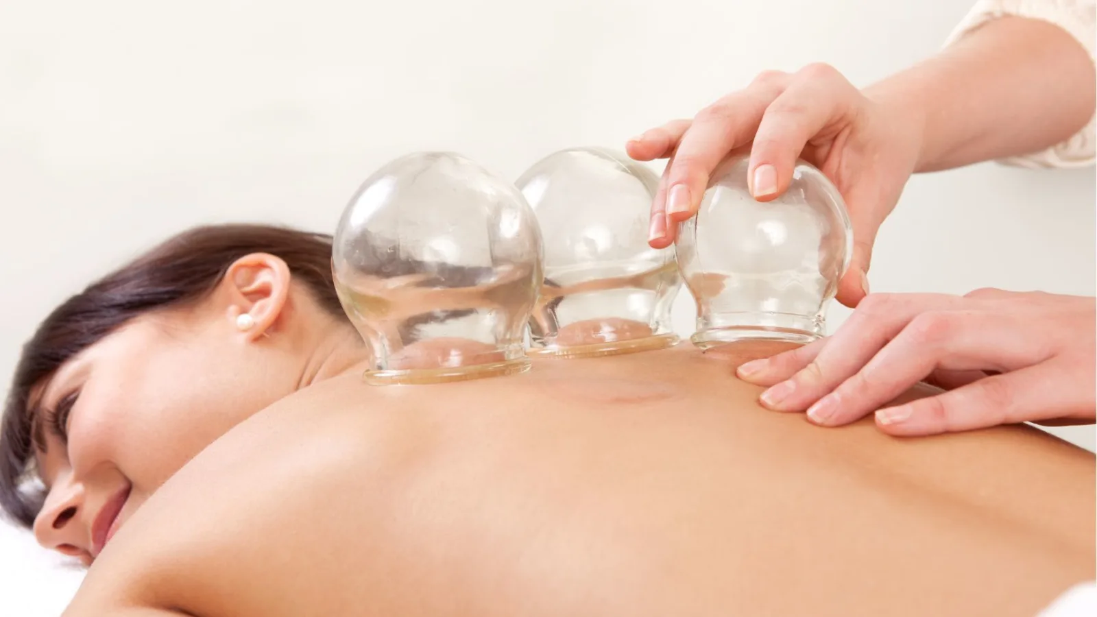Cupping